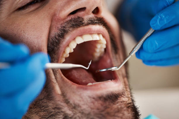Best Urgent Tooth Repair  in Crescent, OK