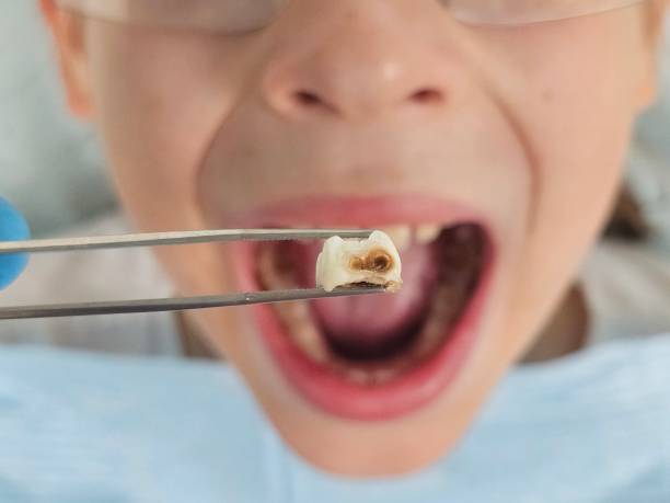 Urgent Tooth Repair in OK
